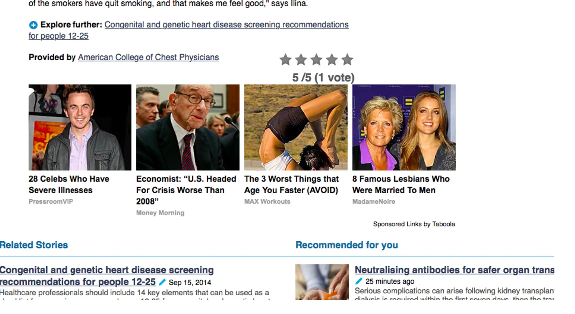 Webpage showing unrelated and potentially irrelevant content recommendations, such as celebrity news, on a scholarly article page, illustrating the issue TrendMD seeks to solve by offering more relevant academic content suggestions.
